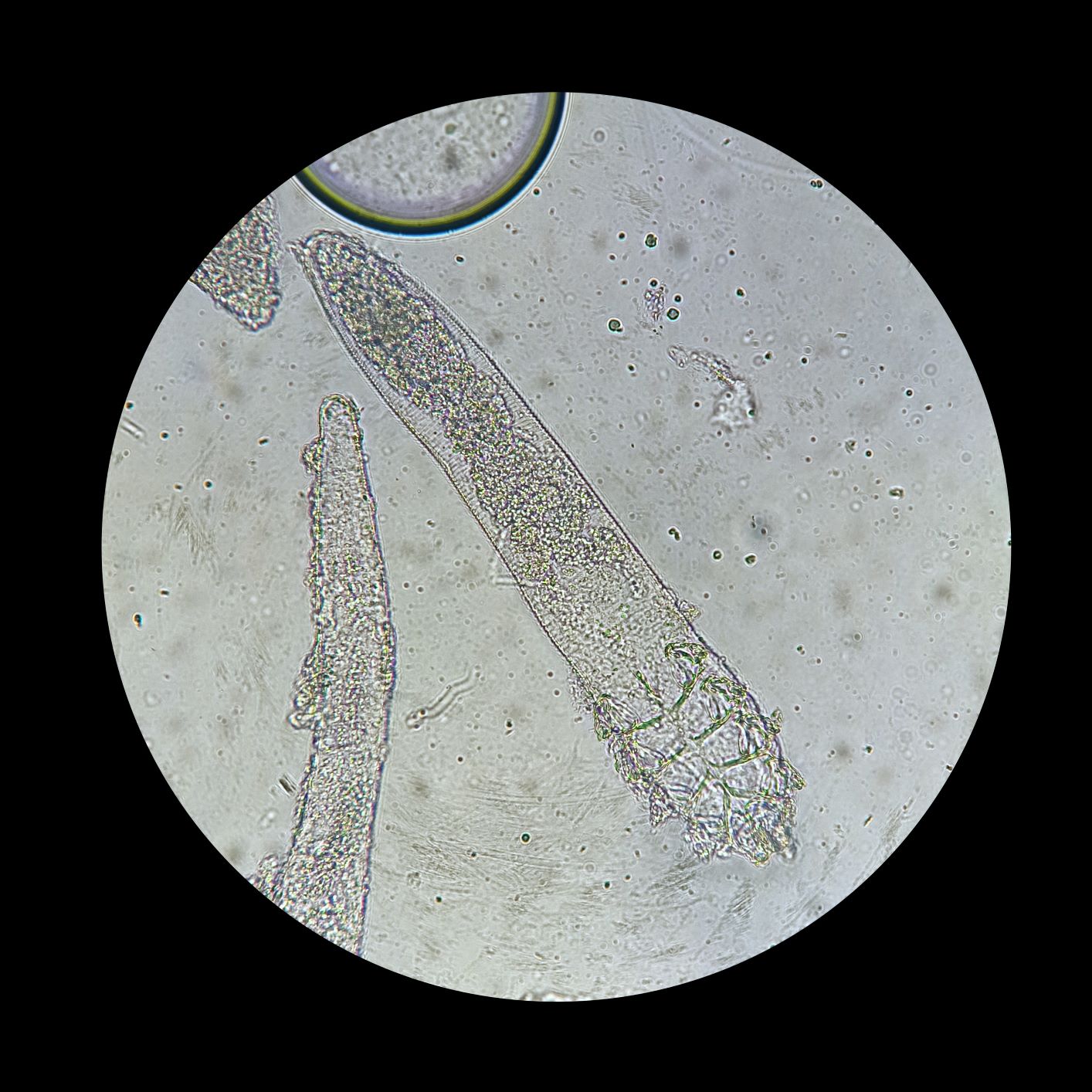 Demodexmilbe unter dem Mikroskop