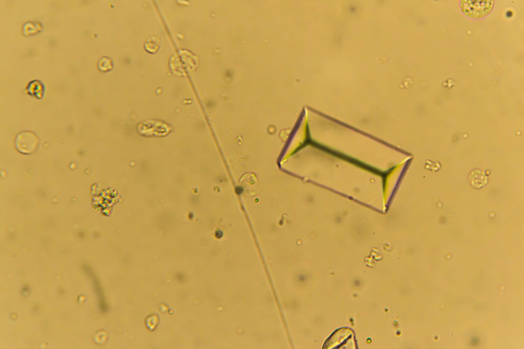 sargdeckelförmigen Struvitkristalle unter Mikroskop